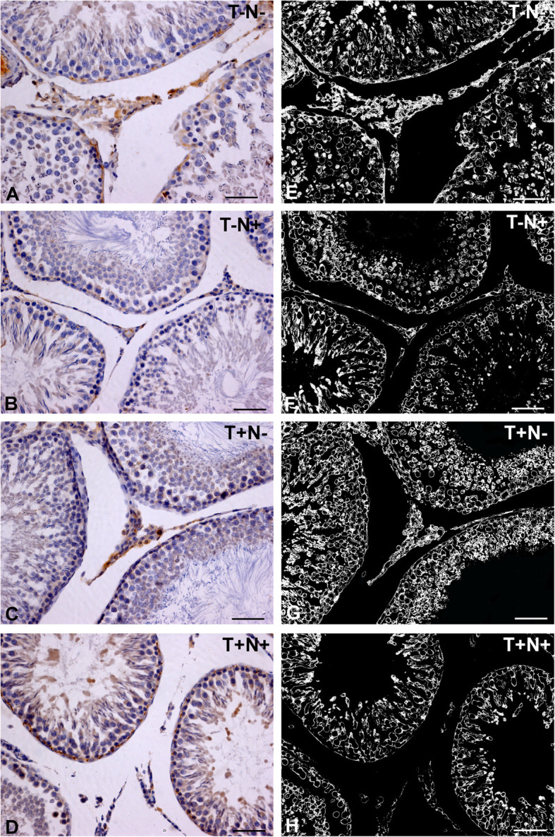 Morphometric analysis and redox state of the testicles in nandrolone decanoate and swimming treated adult male rats.