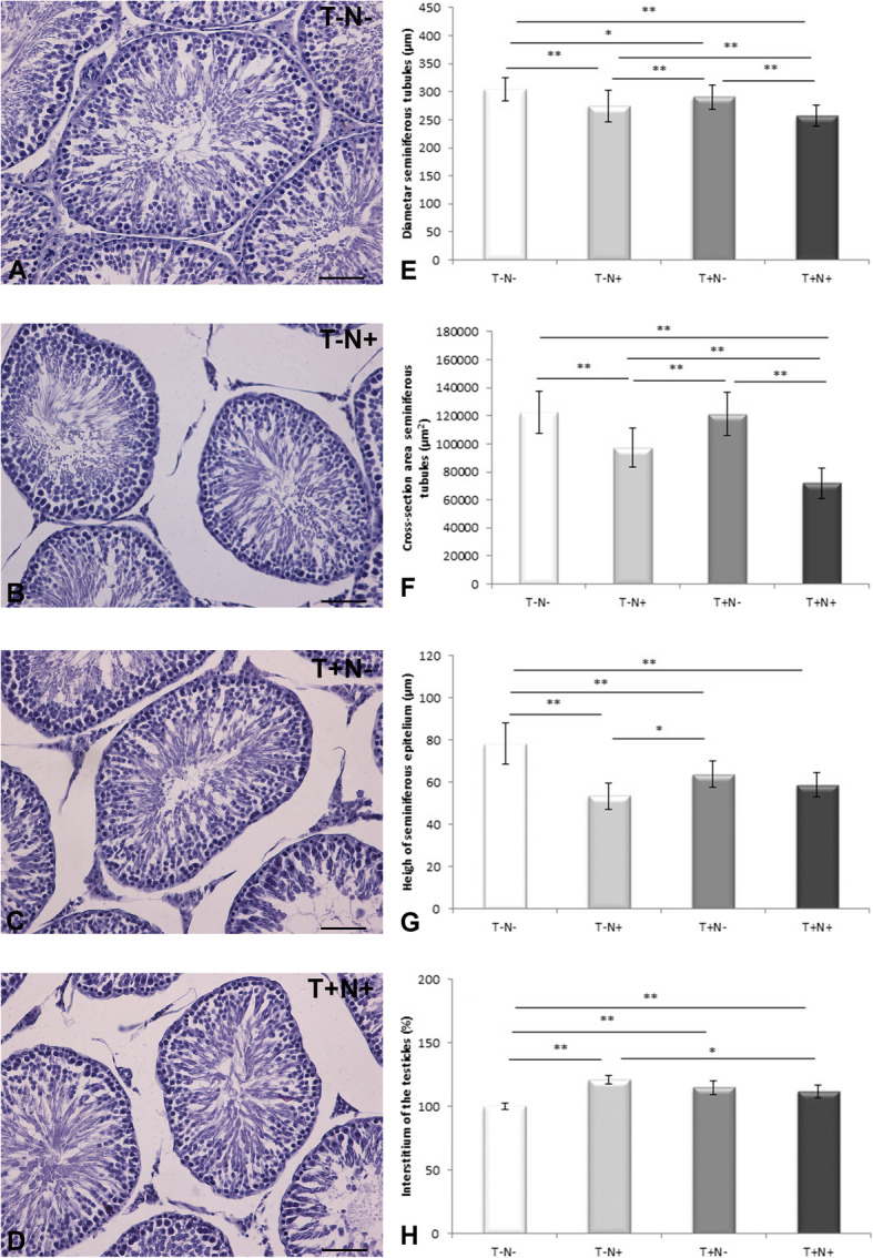 Morphometric analysis and redox state of the testicles in nandrolone decanoate and swimming treated adult male rats.