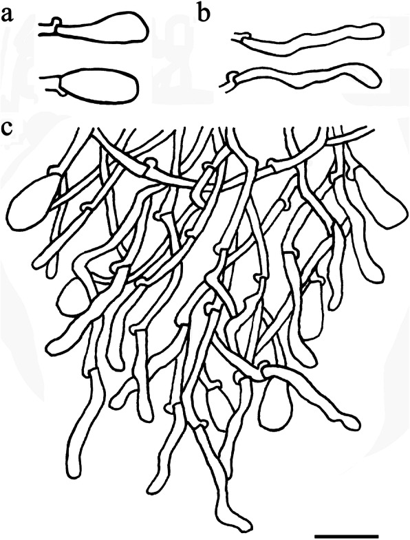 Taxonomy and phylogeny of Resinicium sensu lato from Asia-Pacific revealing a new genus and five new species (Hymenochaetales, Basidiomycota).