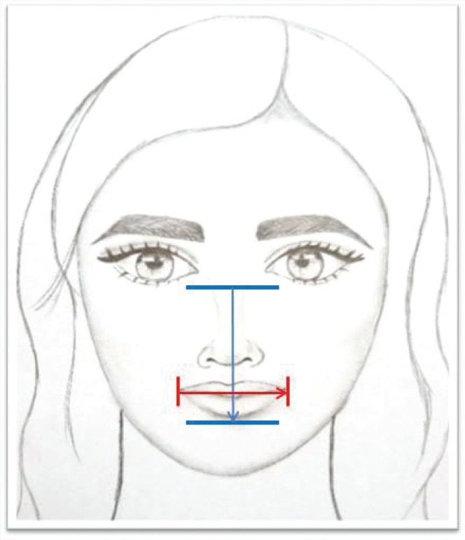 Virtual mask fitting in pediatric patients during COVID-19: A case series.