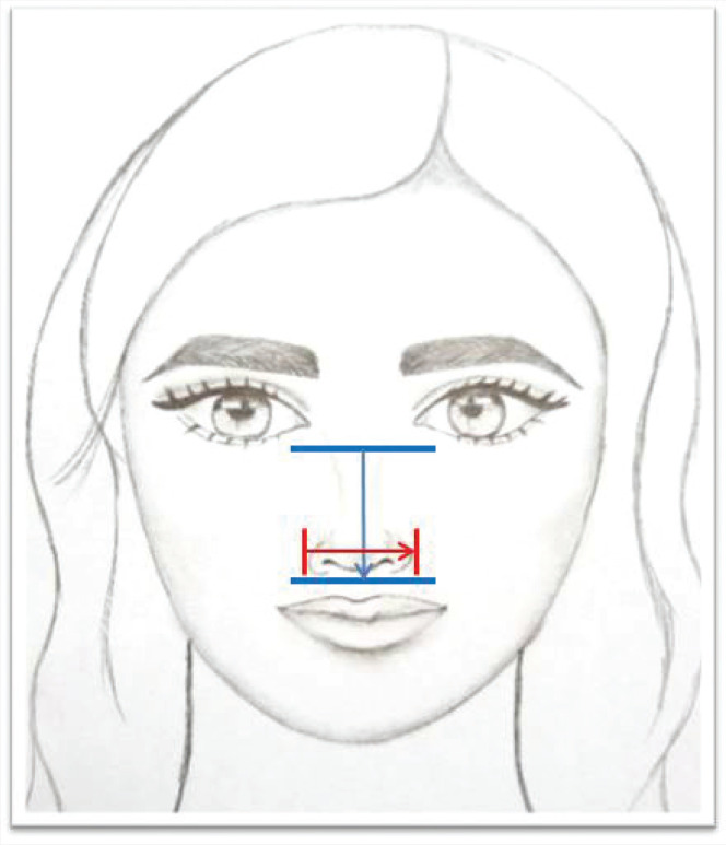 Virtual mask fitting in pediatric patients during COVID-19: A case series.