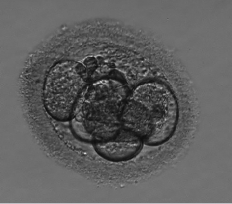 Oocyte Morphology and Reproductive Outcomes - Case Report and Literature Review.