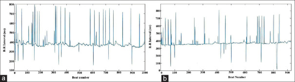 Signal Processing of Heart Rate for Predicting Sepsis in Premature Neonates.