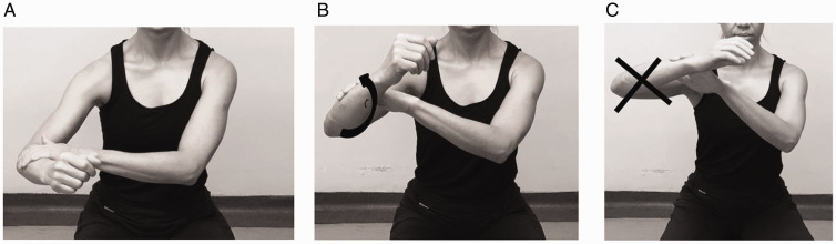 Maximizing Muscle Function in Cuff-Deficient Shoulders: A Rehabilitation Proposal for Reverse Arthroplasty.