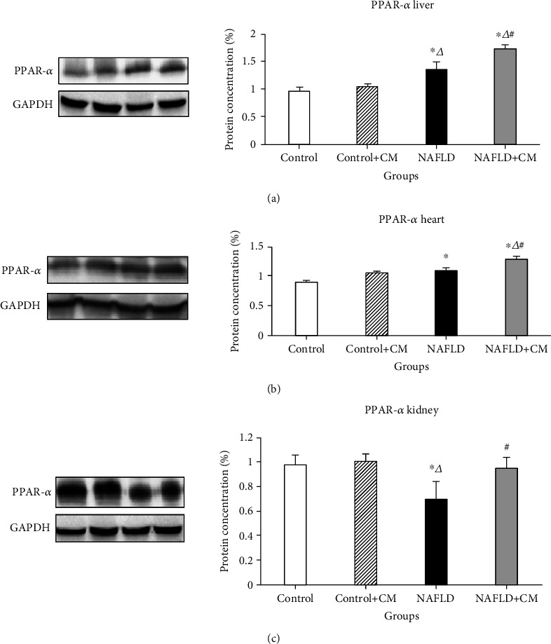 Activation of the Peroxisome Proliferator-Activated Receptors (PPAR-<i>α</i>/<i>γ</i>) and the Fatty Acid Metabolizing Enzyme Protein CPT1A by Camel Milk Treatment Counteracts the High-Fat Diet-Induced Nonalcoholic Fatty Liver Disease.