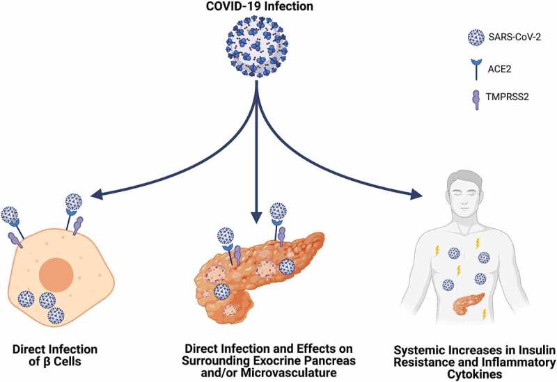 Not so sweet and simple: impacts of SARS-CoV-2 on the β cell.