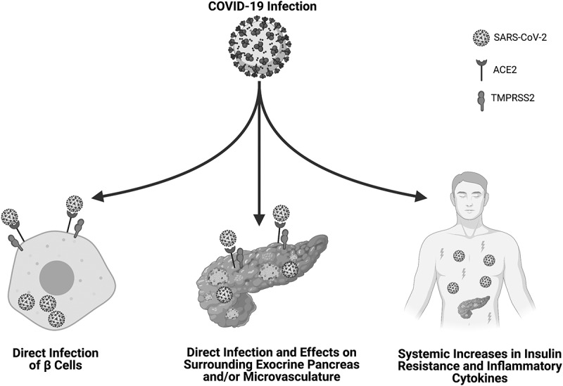 Not so sweet and simple: impacts of SARS-CoV-2 on the β cell.