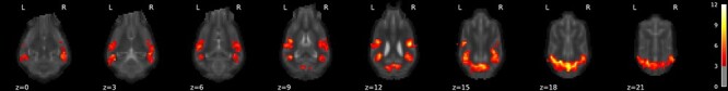 Neural Responses of Pet Dogs Witnessing Their Caregiver's Positive Interactions with a Conspecific: An fMRI Study.