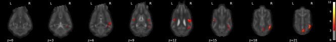 Neural Responses of Pet Dogs Witnessing Their Caregiver's Positive Interactions with a Conspecific: An fMRI Study.