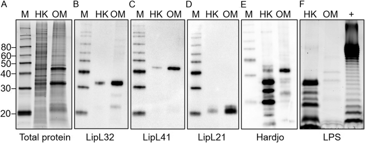 Bovine endometrial cells do not mount an inflammatory response to <i>Leptospira</i>.