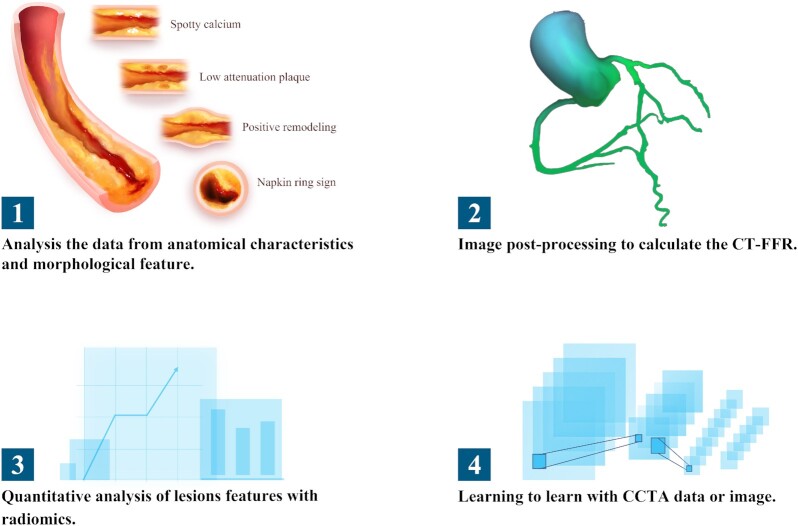 Understanding the predictive value and methods of risk assessment based on coronary computed tomographic angiography in populations with coronary artery disease: a review.