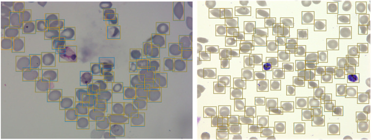 Automated detection and staging of malaria parasites from cytological smears using convolutional neural networks.