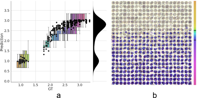 Automated detection and staging of malaria parasites from cytological smears using convolutional neural networks.