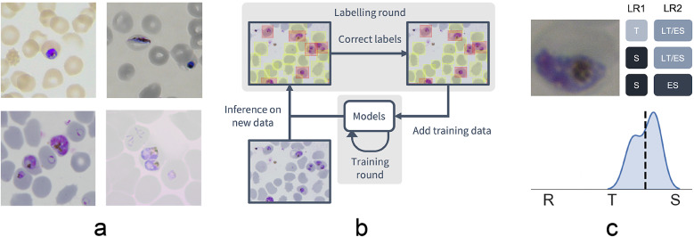 Automated detection and staging of malaria parasites from cytological smears using convolutional neural networks.