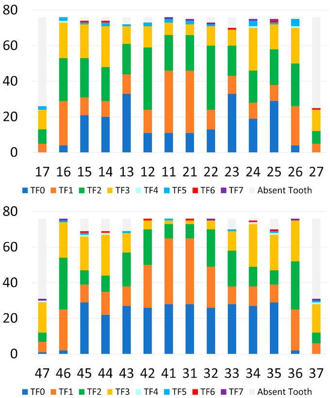 Dental fluorosis severity in children 8-12 years old and associated factors.