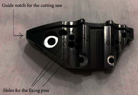 Proposed Geometrical Tool for Cases of Laterally Adapted Tibial Tubercle during Total Knee Replacement.