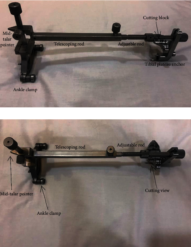 Proposed Geometrical Tool for Cases of Laterally Adapted Tibial Tubercle during Total Knee Replacement.