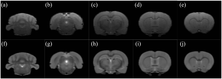 Ratlas-LH: An MRI template of the Lister hooded rat brain with stereotaxic coordinates for neurosurgical implantations.