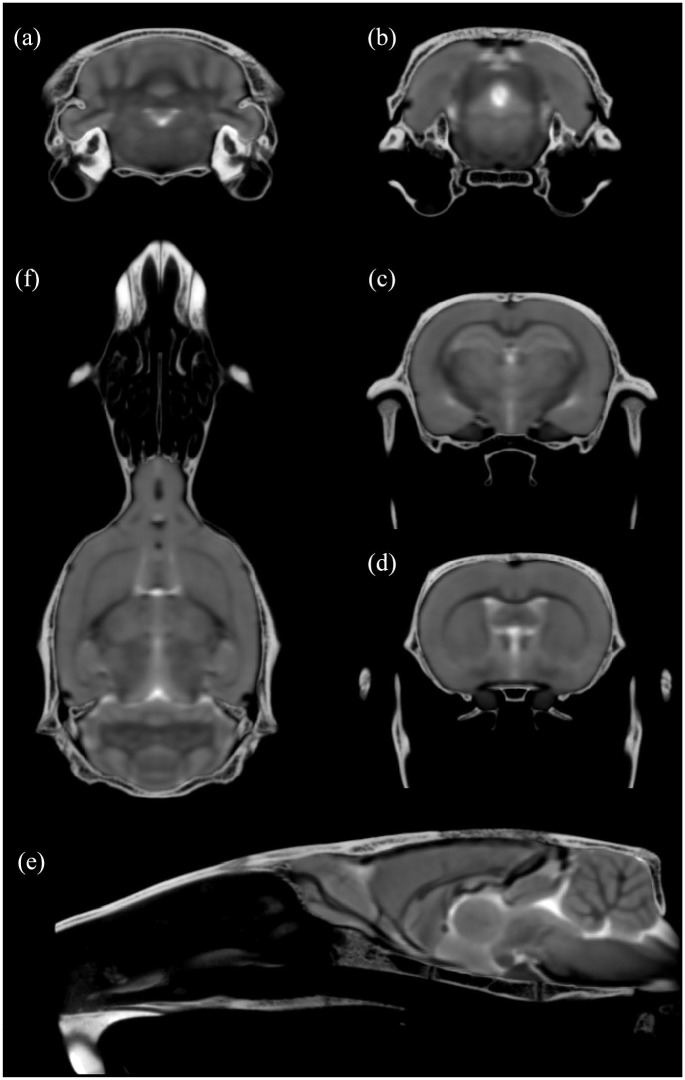 Ratlas-LH: An MRI template of the Lister hooded rat brain with stereotaxic coordinates for neurosurgical implantations.