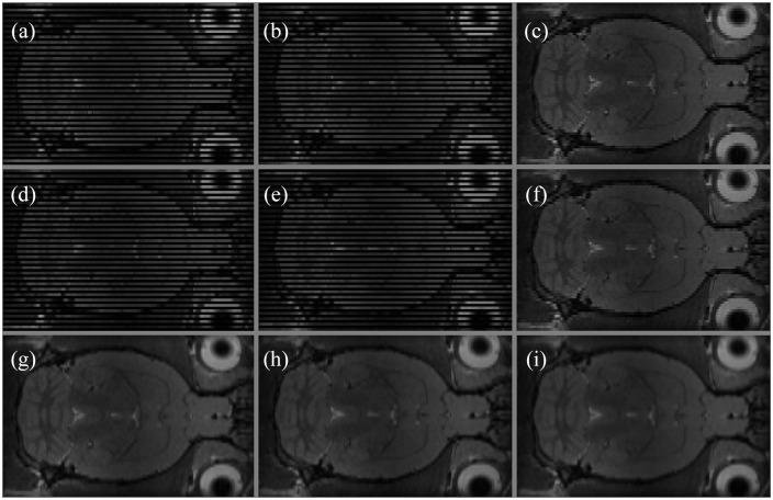 Ratlas-LH: An MRI template of the Lister hooded rat brain with stereotaxic coordinates for neurosurgical implantations.