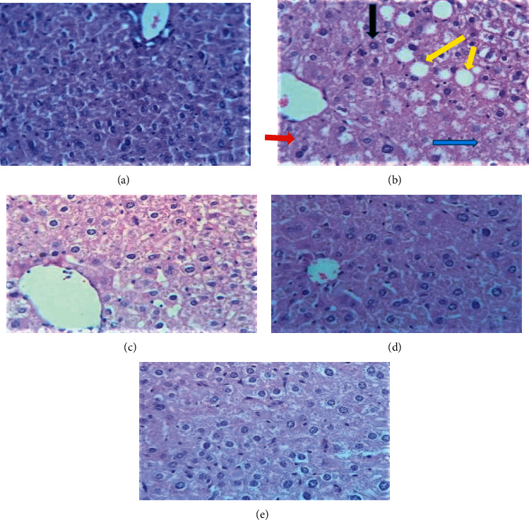 Hepatoprotective Effect of Corm of <i>Ensete ventricosum</i> (Welw.) Cheesman Extract against Isoniazid and Rifampicin Induced Hepatotoxicity in Swiss Albino Mice.