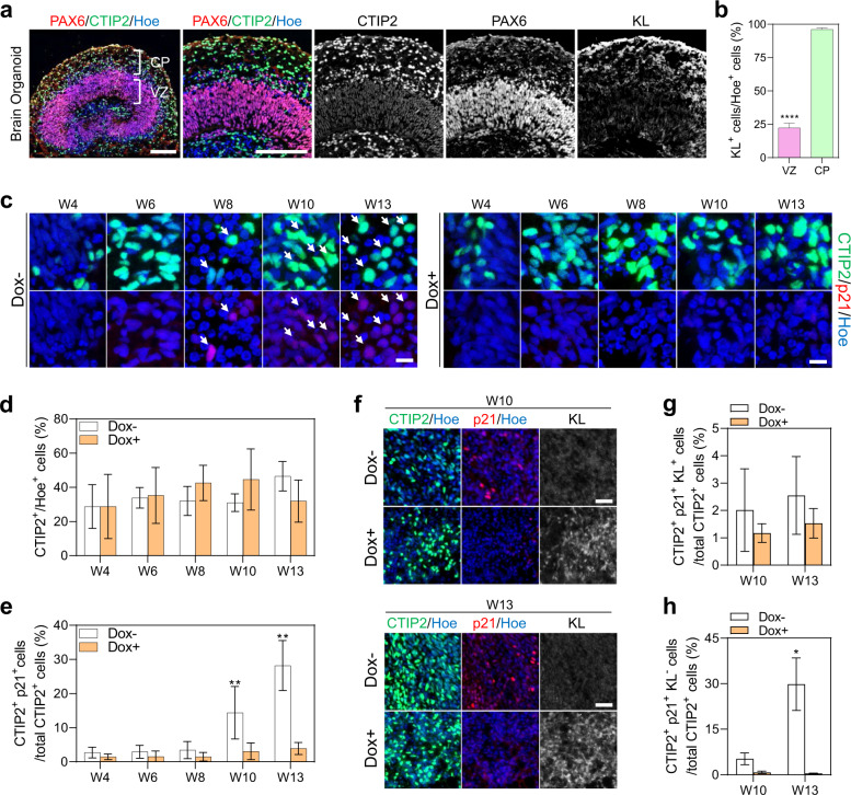 Klotho inhibits neuronal senescence in human brain organoids.