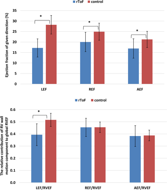 Global and regional right ventricular mechanics in repaired tetralogy of Fallot with chronic severe pulmonary regurgitation: a three-dimensional echocardiography study.