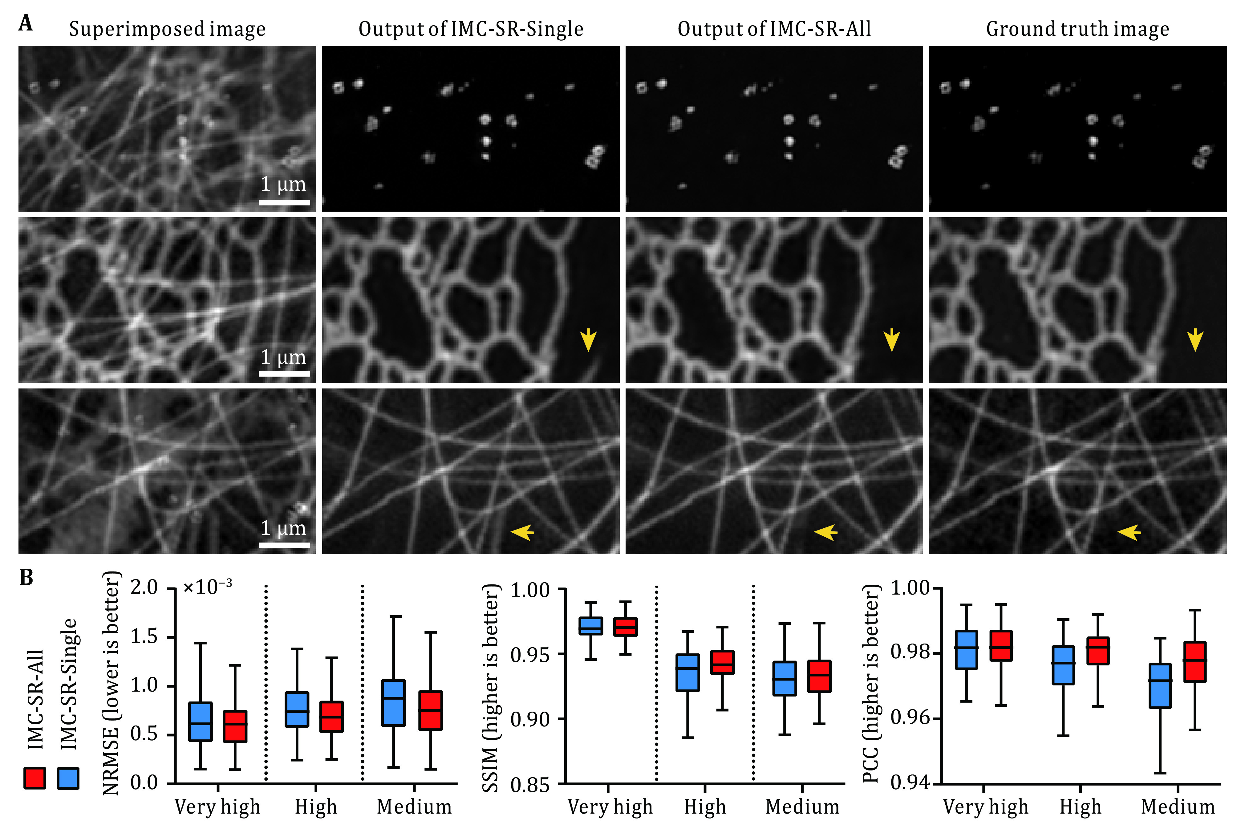 Instant multicolor super-resolution microscopy with deep convolutional neural network.