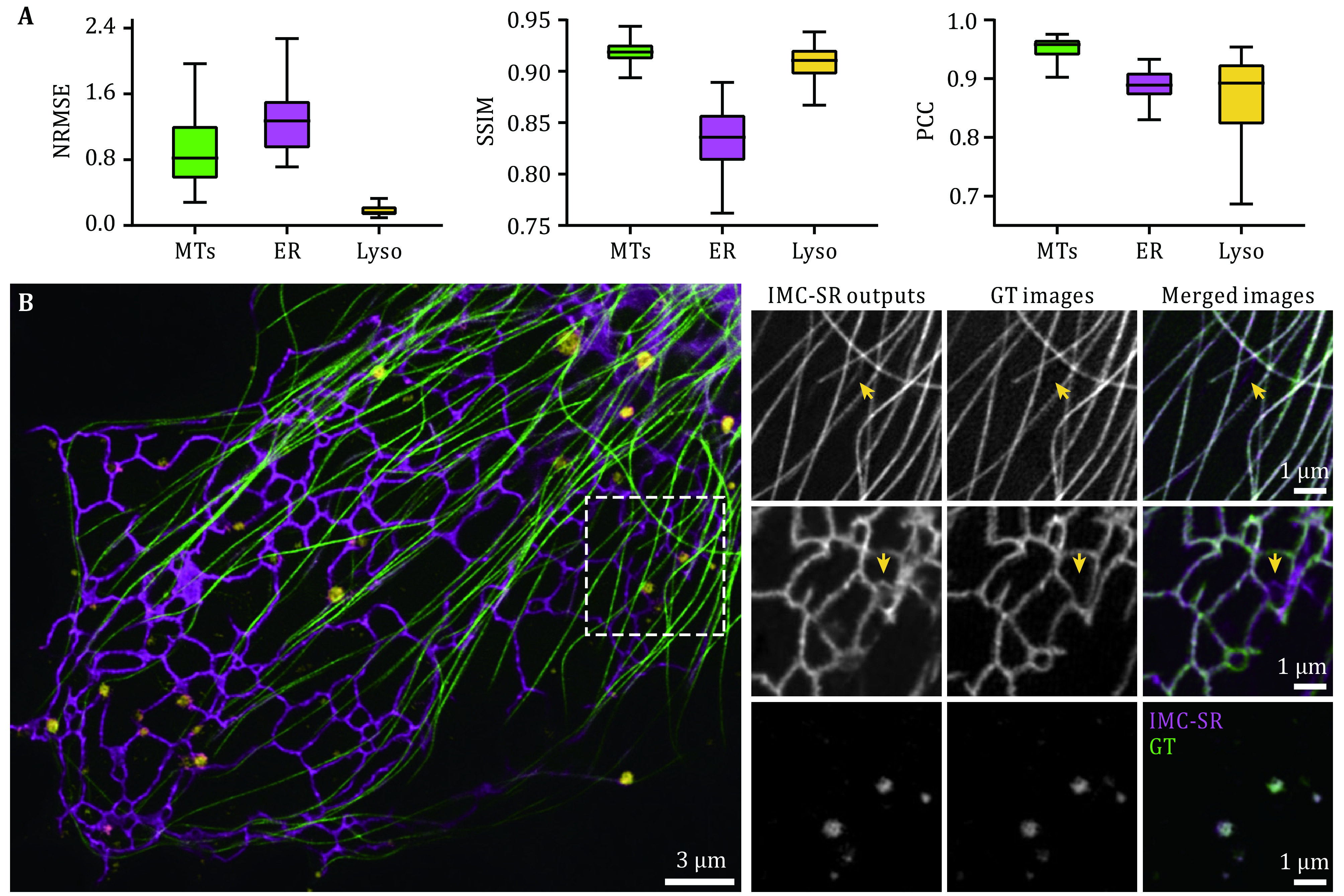 Instant multicolor super-resolution microscopy with deep convolutional neural network.