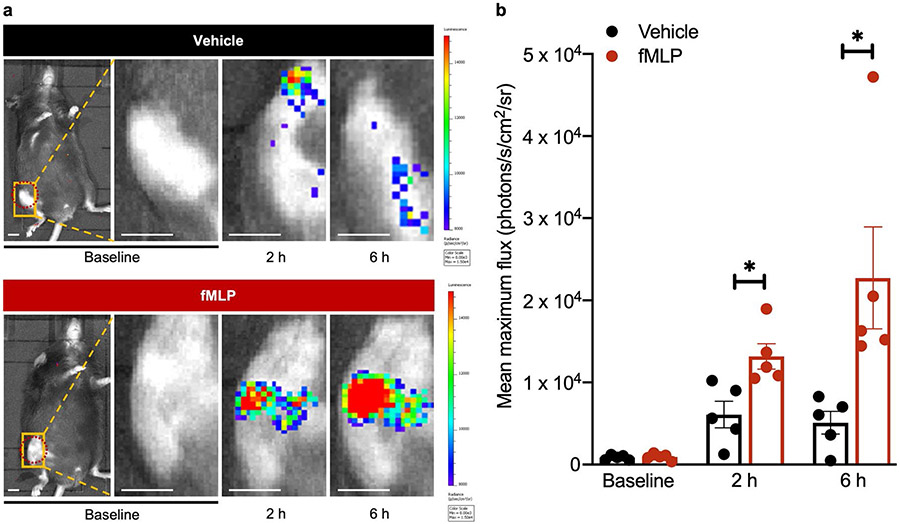 Therapeutic assessment of N-formyl-methionyl-leucyl-phenylalanine (fMLP) in reducing periprosthetic joint infection.