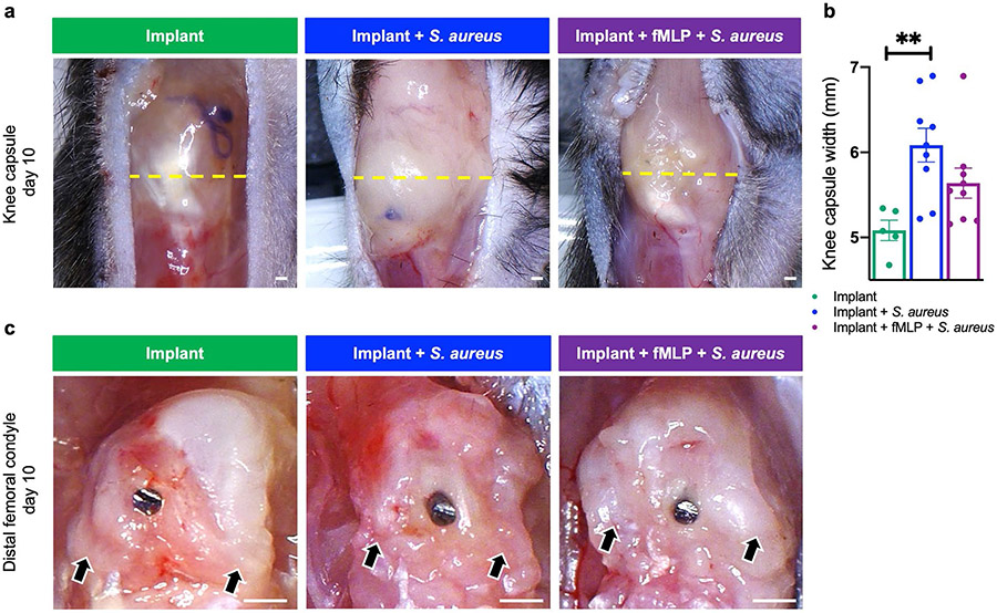 Therapeutic assessment of N-formyl-methionyl-leucyl-phenylalanine (fMLP) in reducing periprosthetic joint infection.