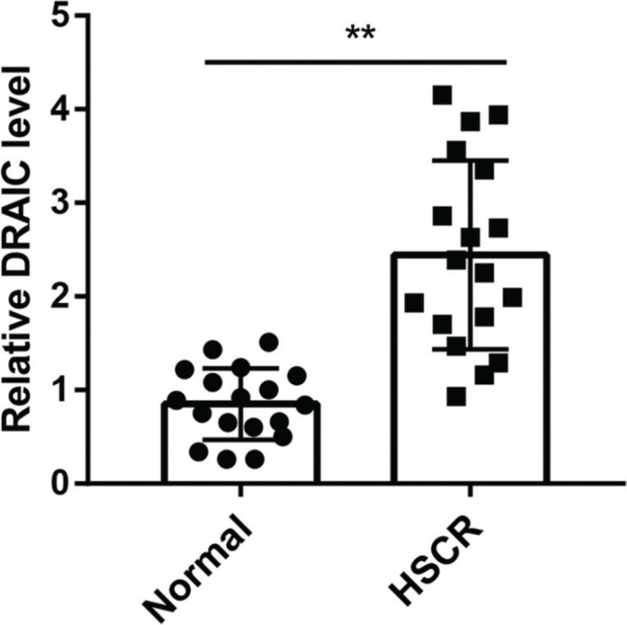 LncRNA DRAIC regulates cell proliferation and migration by affecting the miR-34a-5p/ITGA6 signal axis in Hirschsprung's disease.