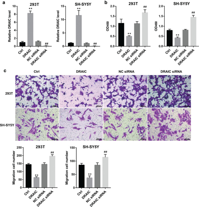 LncRNA DRAIC regulates cell proliferation and migration by affecting the miR-34a-5p/ITGA6 signal axis in Hirschsprung's disease.