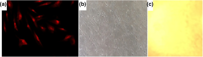 Early and late effects of absorbable poly(vinyl alcohol) hernia mesh to tissue reconstruction.