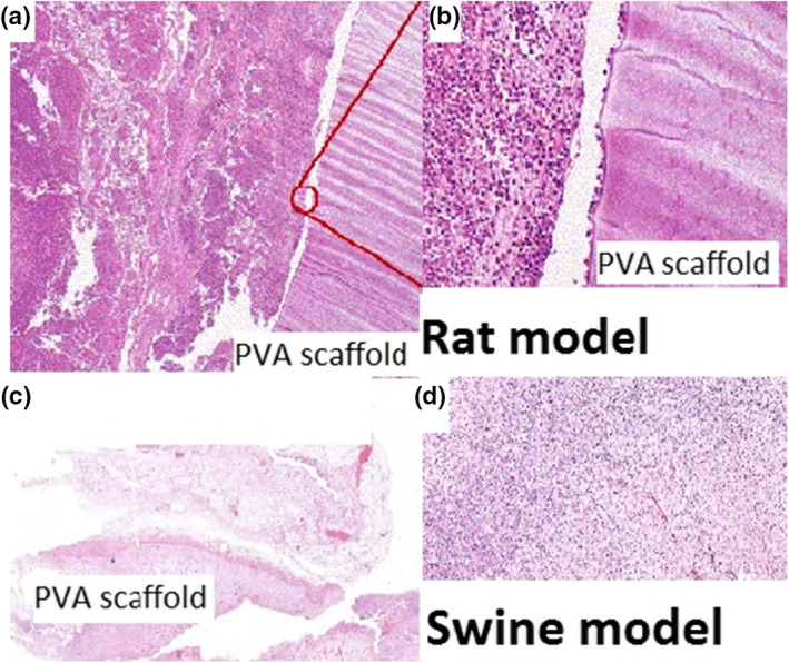 Early and late effects of absorbable poly(vinyl alcohol) hernia mesh to tissue reconstruction.