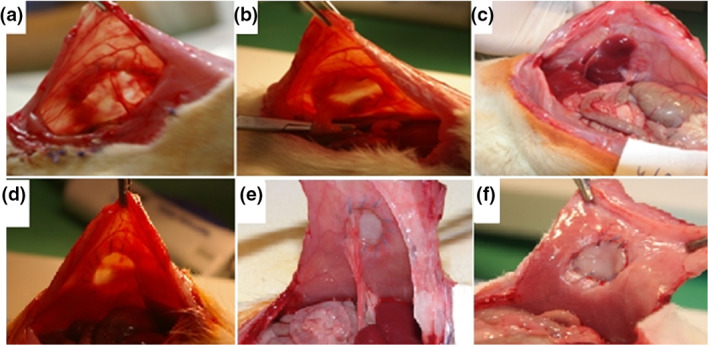 Early and late effects of absorbable poly(vinyl alcohol) hernia mesh to tissue reconstruction.