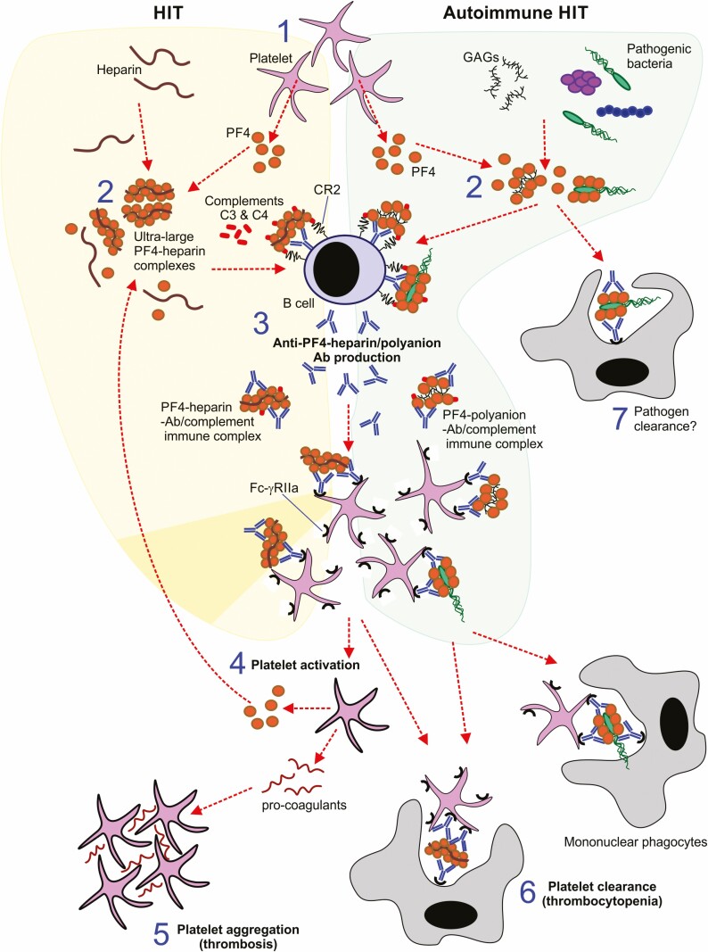 The clinical correlates of vaccine-induced immune thrombotic thrombocytopenia after immunisation with adenovirus vector-based SARS-CoV-2 vaccines.