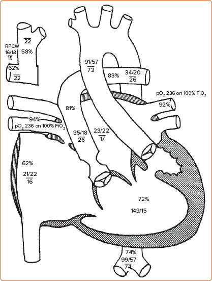 Unknown Risks of Transplantation in Adults with Congenital Heart Disease.