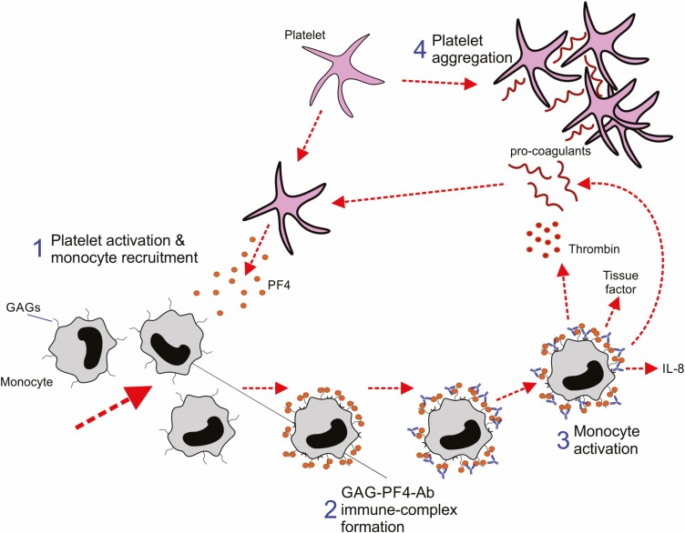 The clinical correlates of vaccine-induced immune thrombotic thrombocytopenia after immunisation with adenovirus vector-based SARS-CoV-2 vaccines.