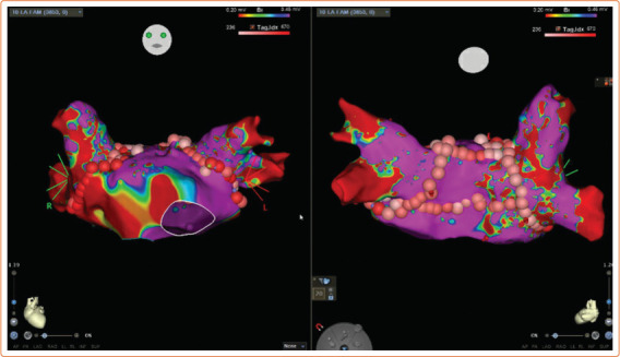 Unknown Risks of Transplantation in Adults with Congenital Heart Disease.