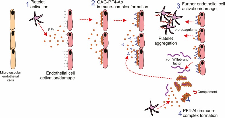 The clinical correlates of vaccine-induced immune thrombotic thrombocytopenia after immunisation with adenovirus vector-based SARS-CoV-2 vaccines.