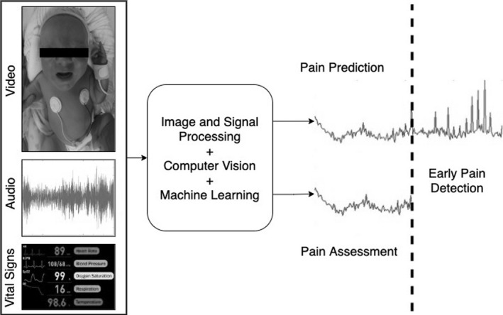 Future roles of artificial intelligence in early pain management of newborns.