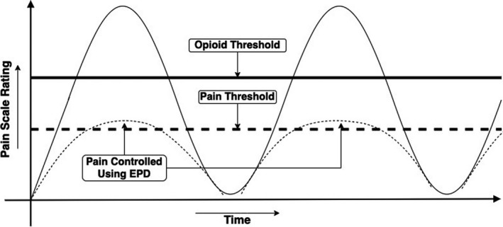 Future roles of artificial intelligence in early pain management of newborns.