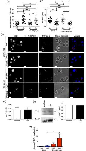 Rickettsia conorii survival in THP-1 macrophages involves host lipid droplet alterations and active rickettsial protein production