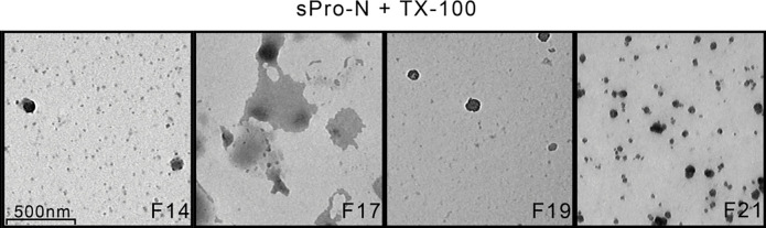 Assembly of tetraspanins, galectin-3, and distinct N-glycans defines the solubilization signature of seminal prostasomes from normozoospermic and oligozoospermic men.