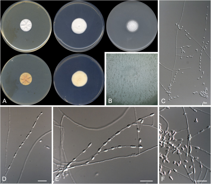 A revision of malbranchea-like fungi from clinical specimens in the United States of America reveals unexpected novelty.