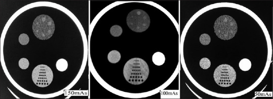 Evaluation and comparison of performance of low-dose 128-slice CT scanner with different mAs values: A phantom study.