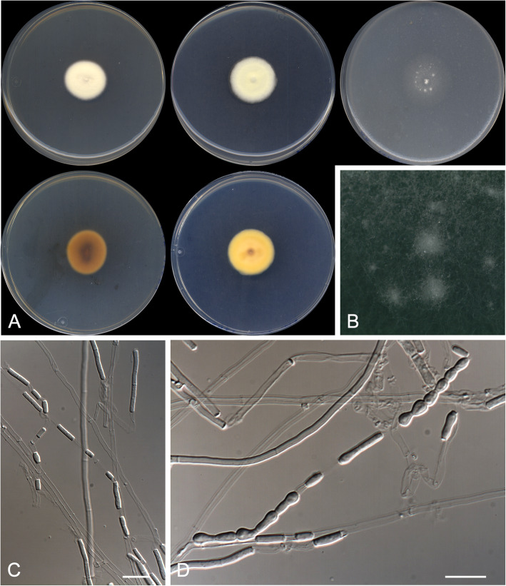 A revision of malbranchea-like fungi from clinical specimens in the United States of America reveals unexpected novelty.