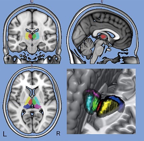 Fluctuations in Arousal Correlate with Neural Activity in the Human Thalamus.