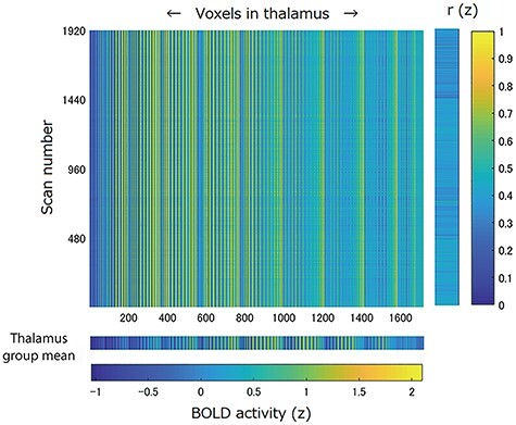 Fluctuations in Arousal Correlate with Neural Activity in the Human Thalamus.